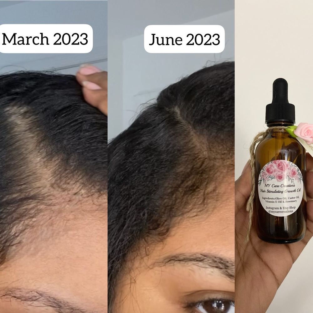 Hair Growth Oil